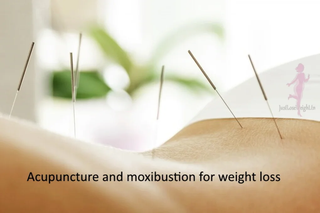 Acupuncture and moxibustion for weight loss