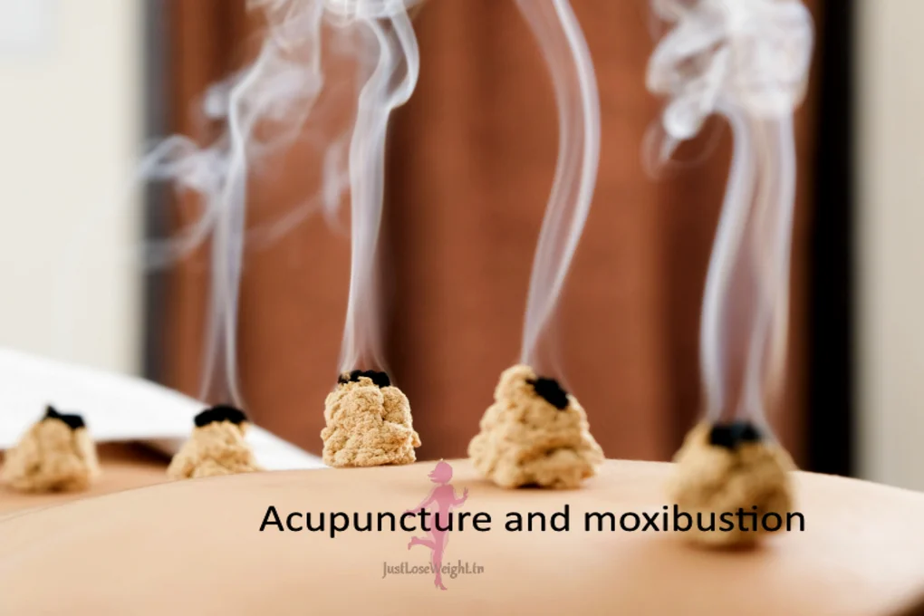 acupuncture and moxibustion