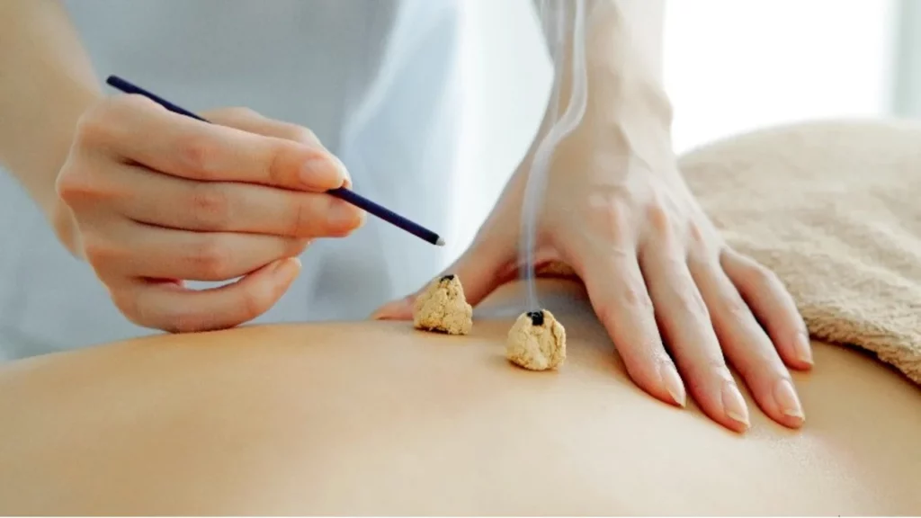 Acupuncture and moxibustion for weight loss